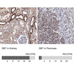DBT Antibody, Novus Biologicals:Antibodies:Primary Antibodies